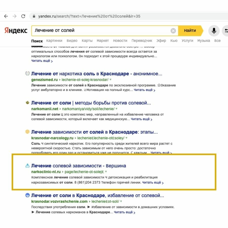 Nl1 (4)